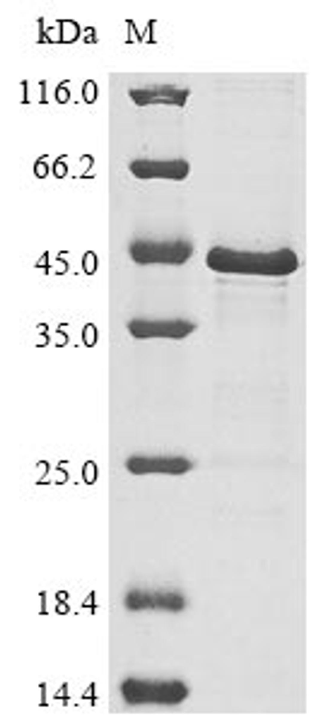 (Tris-Glycine gel) Discontinuous SDS-PAGE (reduced) with 5% enrichment gel and 15% separation gel.