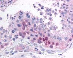 Immunohistochemistry staining of MAGEB2 in testis (formalin-fixed paraffin embedded) tissue using MAGEB2 Antibody.