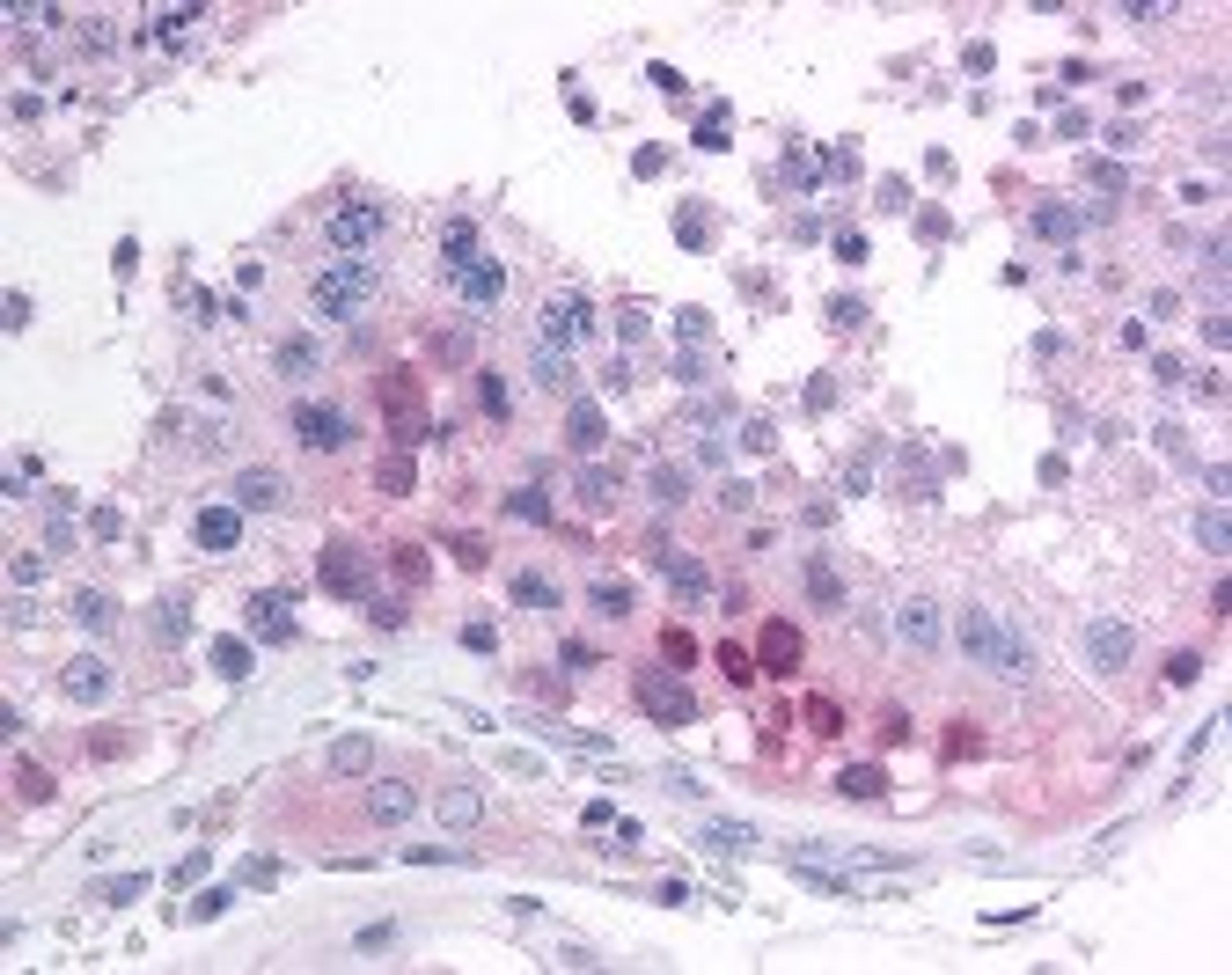 Immunohistochemistry staining of MAGEB2 in testis (formalin-fixed paraffin embedded) tissue using MAGEB2 Antibody.