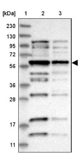 Western Blot: SAMD11 Antibody [NBP2-13277] - Lane 1: Marker [kDa] 230, 130, 95, 72, 56, 36, 28, 17, 11<br/>Lane 2: Human cell line RT-4<br/>Lane 3: Human cell line U-251MG sp