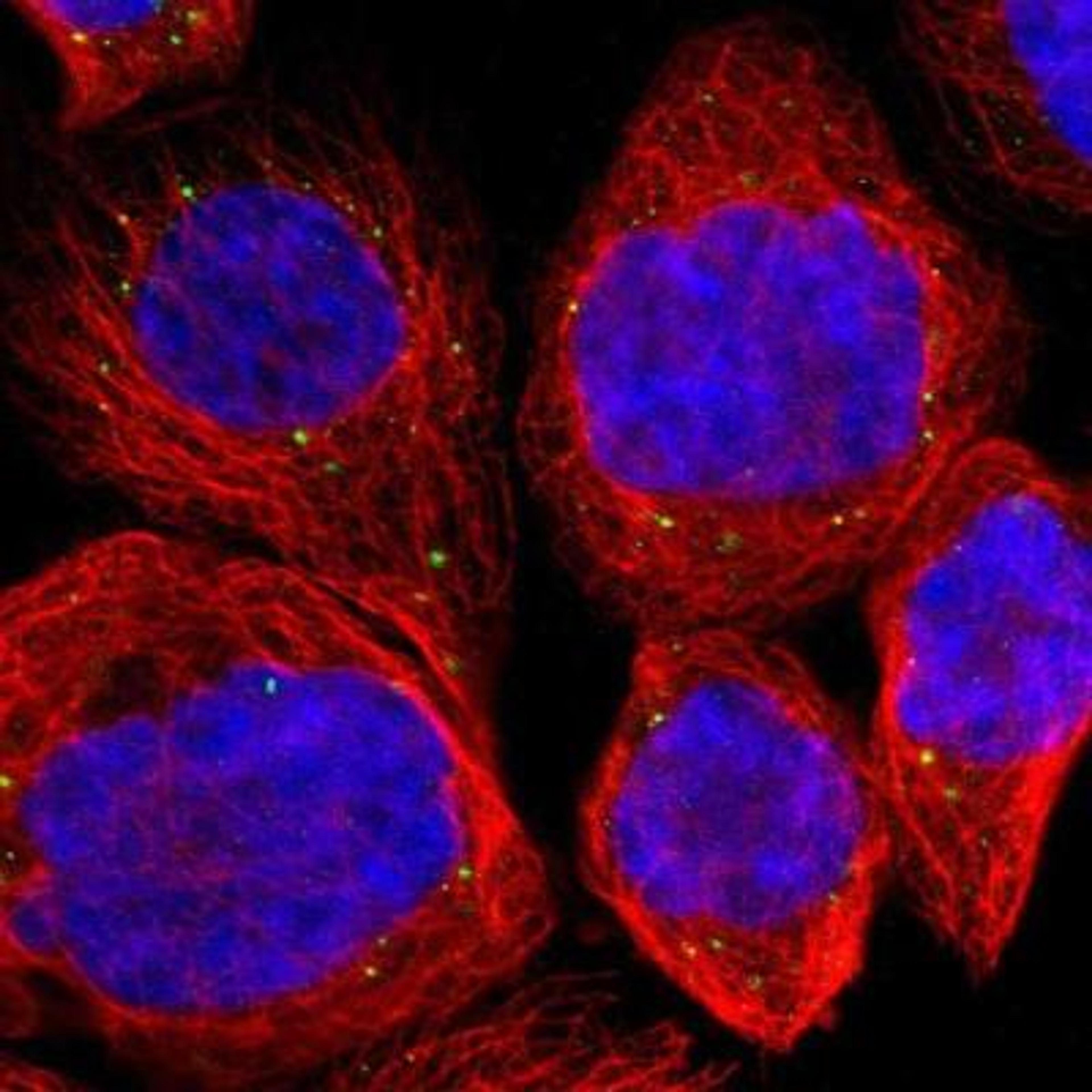 Immunocytochemistry/Immunofluorescence: SALL2 Antibody [NBP2-13276] - Staining of human cell line A-431 shows positivity in vesicles.