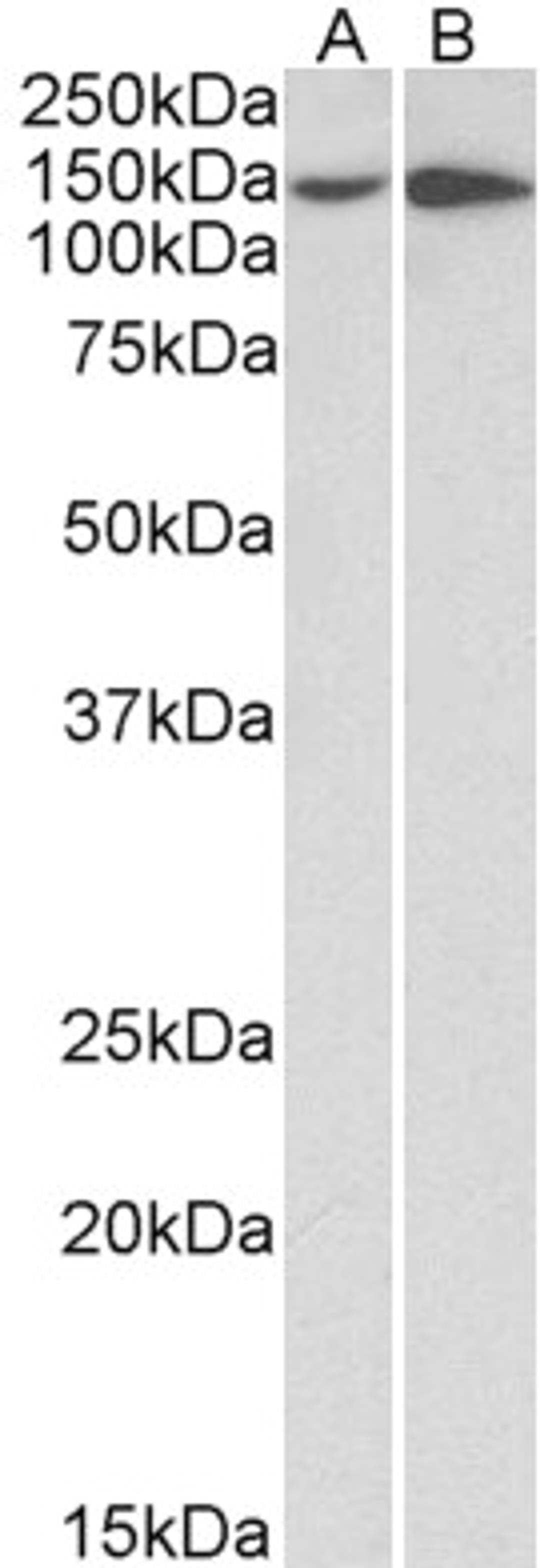 43-636 (0.5ug/ml) staining of HeLa (A) and HepG2 (B) lysates (35ug protein in RIPA buffer). Primary incubation was 1 hour. Detected by chemiluminescence.