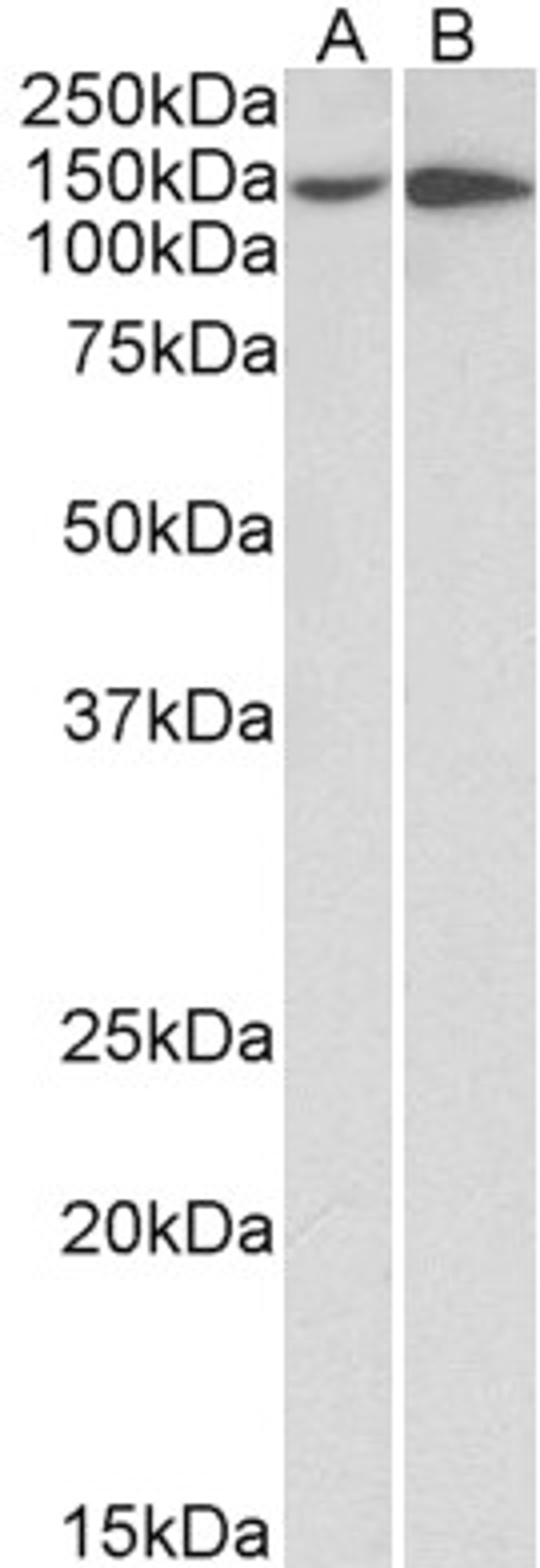 43-636 (0.5ug/ml) staining of HeLa (A) and HepG2 (B) lysates (35ug protein in RIPA buffer). Primary incubation was 1 hour. Detected by chemiluminescence.