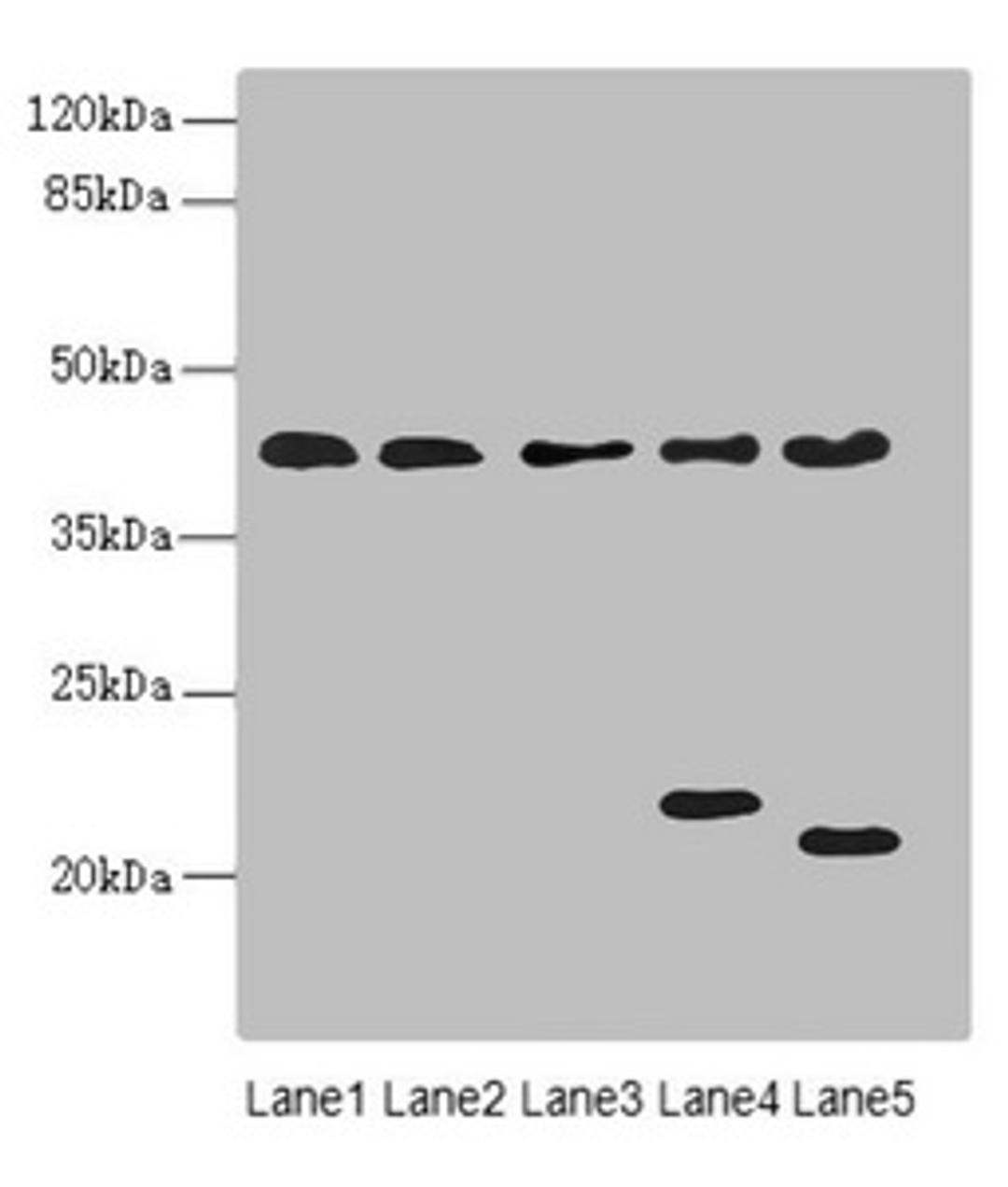 Western blot. All lanes: LHX6 antibody at 3.02ug/ml. Lane 1: HepG2 whole cell lysate. Lane 2: U87 whole cell lysate. Lane 3: NIH/3T3 whole cell lysate. Lane 4: Mouse brain tissue. Lane 5: Mouse liver tissue. Secondary. Goat polyclonal to rabbit IgG at 1/10000 dilution. Predicted band size: 41, 39, 44, 42, 20 kDa. Observed band size: 41, 22, 20 kDa. 