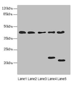 Western blot. All lanes: LHX6 antibody at 3.02ug/ml. Lane 1: HepG2 whole cell lysate. Lane 2: U87 whole cell lysate. Lane 3: NIH/3T3 whole cell lysate. Lane 4: Mouse brain tissue. Lane 5: Mouse liver tissue. Secondary. Goat polyclonal to rabbit IgG at 1/10000 dilution. Predicted band size: 41, 39, 44, 42, 20 kDa. Observed band size: 41, 22, 20 kDa. 