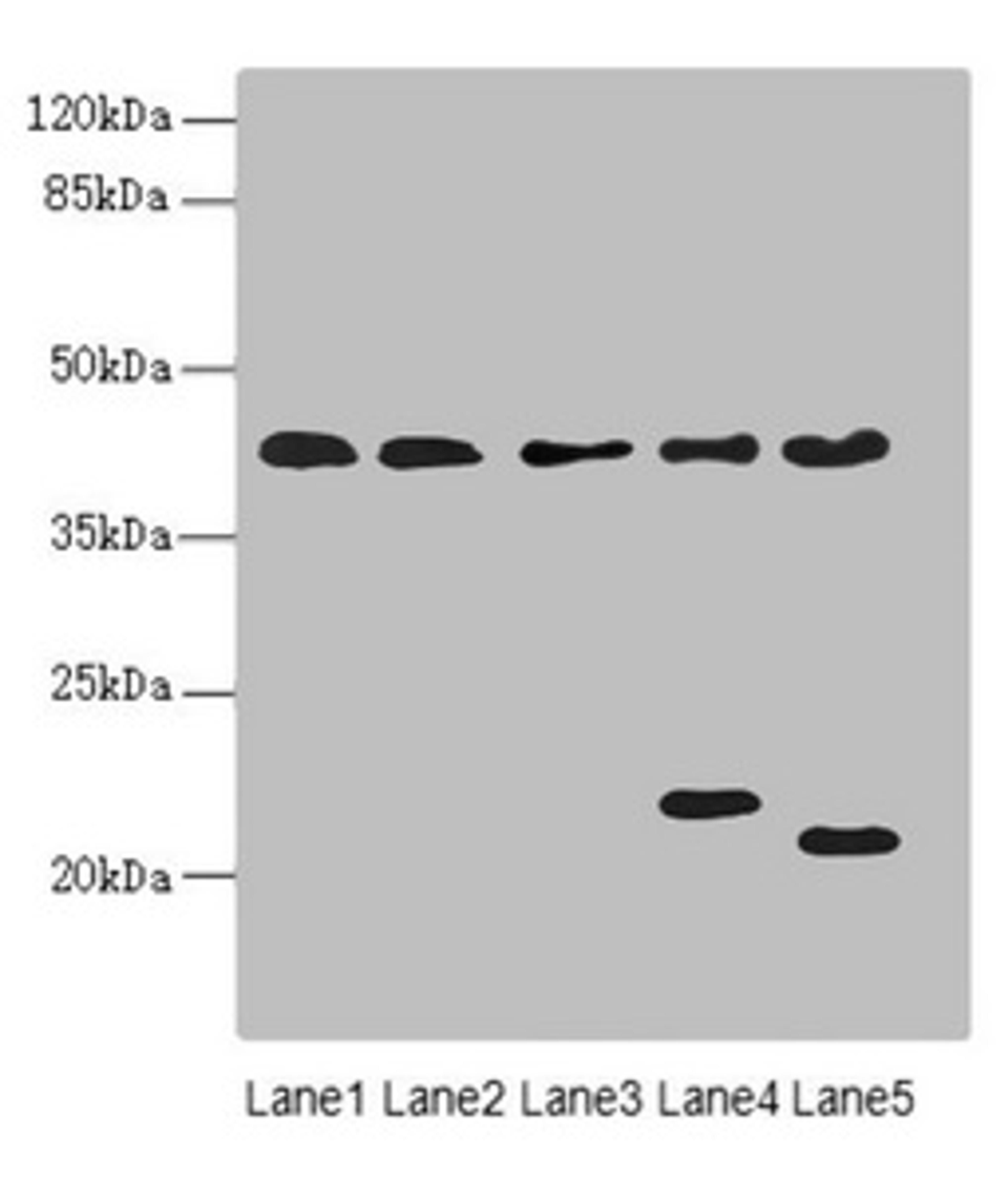 Western blot. All lanes: LHX6 antibody at 3.02ug/ml. Lane 1: HepG2 whole cell lysate. Lane 2: U87 whole cell lysate. Lane 3: NIH/3T3 whole cell lysate. Lane 4: Mouse brain tissue. Lane 5: Mouse liver tissue. Secondary. Goat polyclonal to rabbit IgG at 1/10000 dilution. Predicted band size: 41, 39, 44, 42, 20 kDa. Observed band size: 41, 22, 20 kDa. 