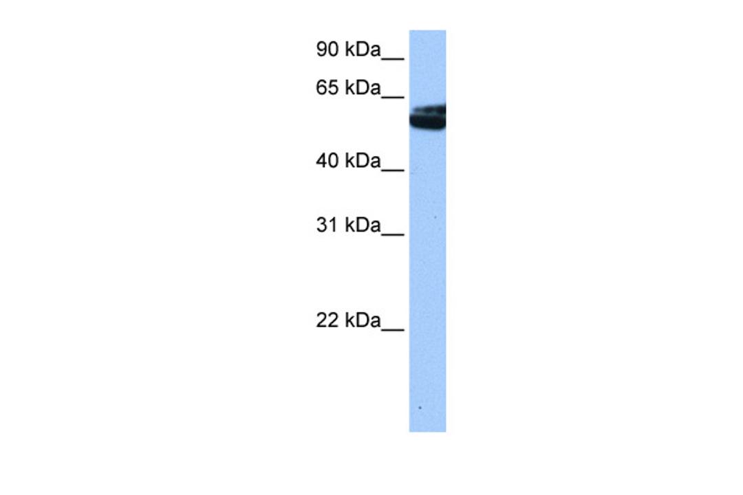 Antibody used in WB on Human HeLa at 0.2-1 ug/ml.