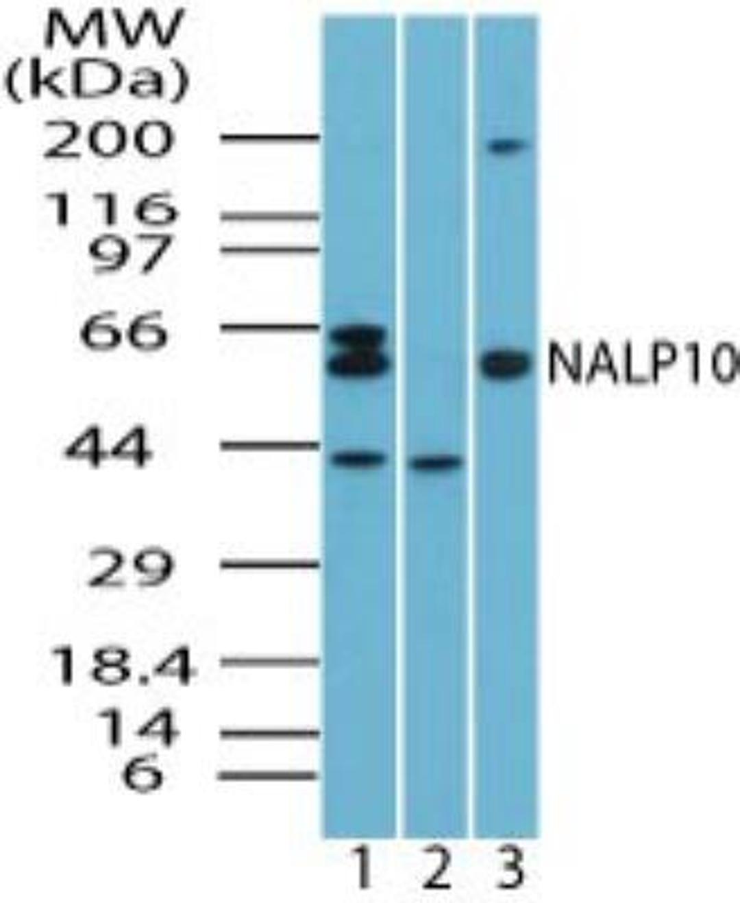 Western Blot: NLRP10 Antibody [NBP2-24606] - Analysis of NALP10 in HeLa cell lysate in the 1) absence and 2) presence of immunizing peptide and 3) RAW cell lysate using NBP2-24606 at 1.0 ug/ml.