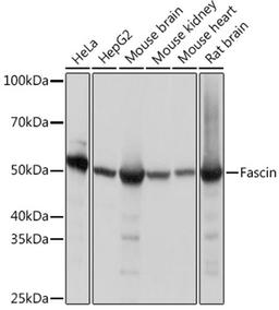 Western blot - Fascin Rabbit mAb (A9566)