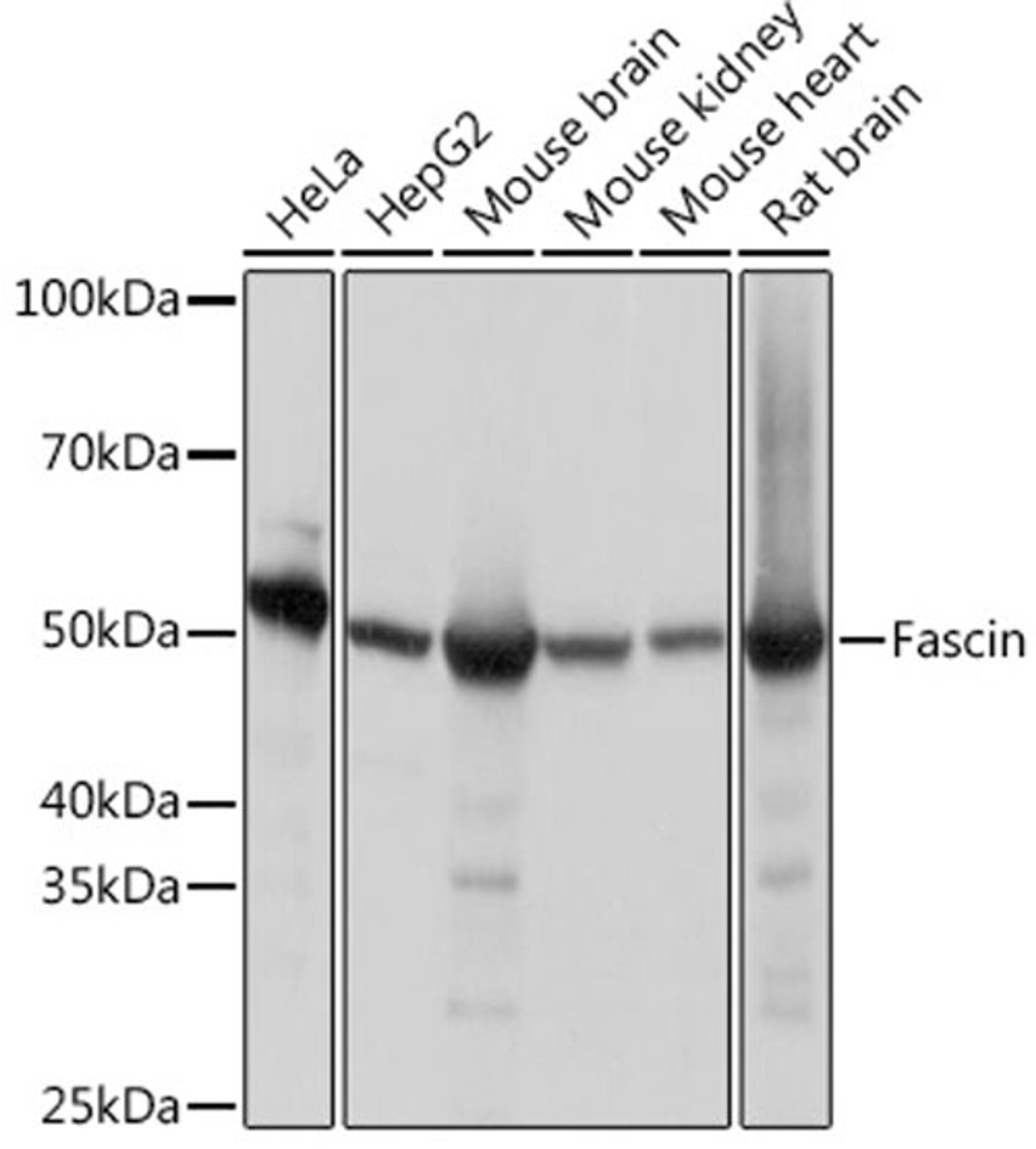 Western blot - Fascin Rabbit mAb (A9566)