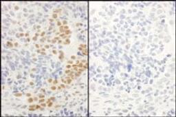 Detection of human Phospho-RelA (S536) by immunohistochemistry.