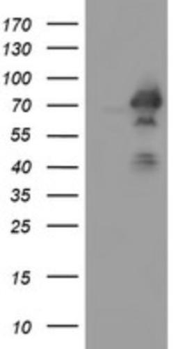 Western Blot: ACBD3 Antibody (1G2) [NBP2-46478] - Analysis of HEK293T cells were transiently transfected with the pCMV6-ENTRY control (Left lane) or pCMV6-ENTRY ACBD3.