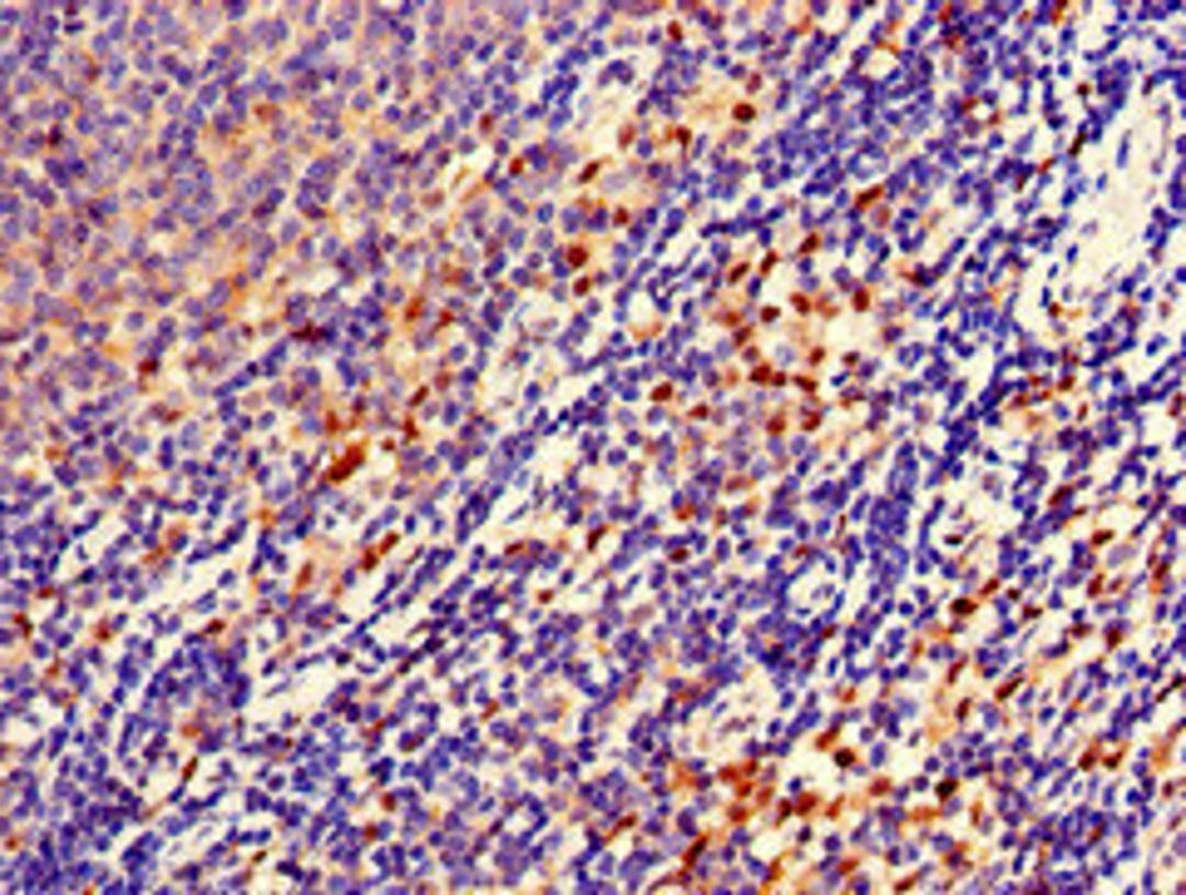 Immunohistochemistry of paraffin-embedded human lymph node tissue using CSB-PA771441LA01HU at dilution of 1:100