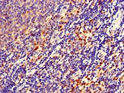Immunohistochemistry of paraffin-embedded human lymph node tissue using CSB-PA771441LA01HU at dilution of 1:100