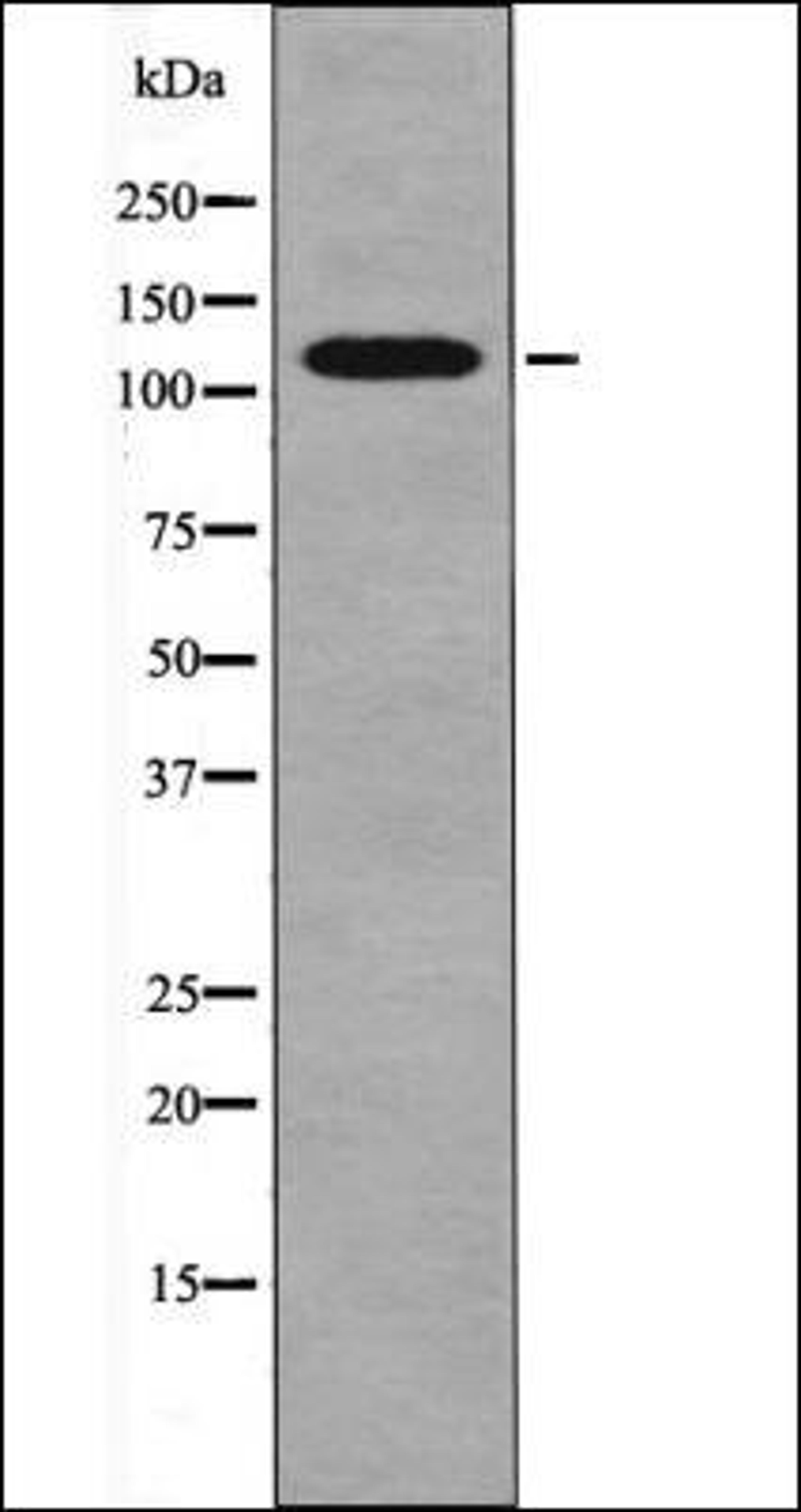 Western blot analysis of K562 whole cell lysates using CBL -Phospho-Tyr731- antibody