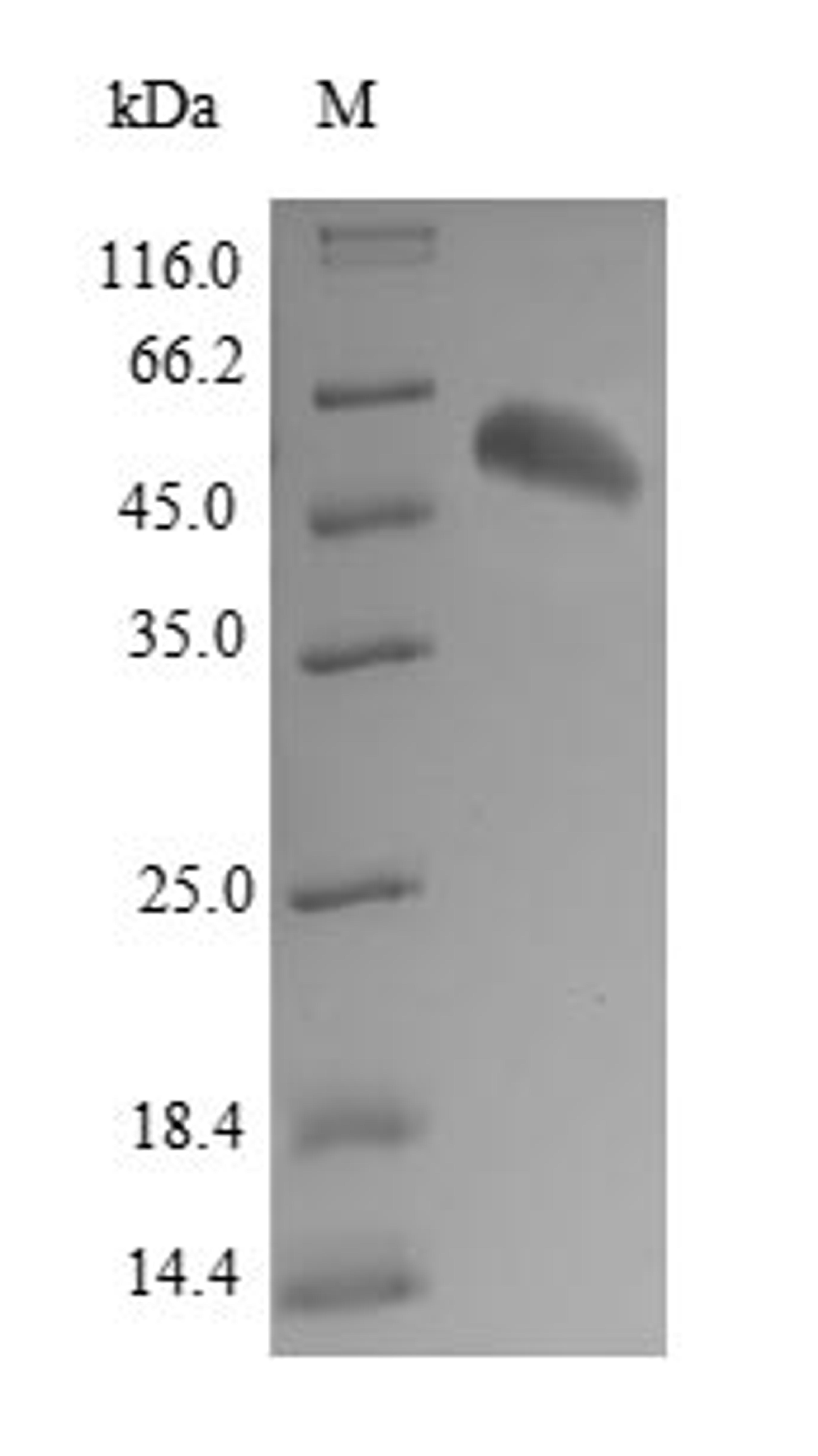 (Tris-Glycine gel) Discontinuous SDS-PAGE (reduced) with 5% enrichment gel and 15% separation gel.