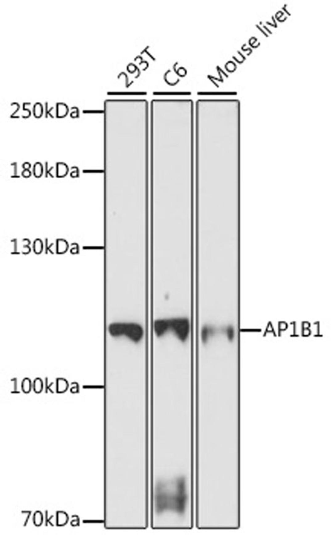 Western blot - AP1B1 antibody (A16304)