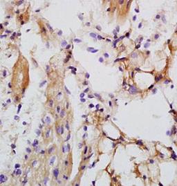 Paraffin-embedded rat heart tissue fixed with 4% paraformaldehyde. Antigen retrieval by boiling with citrate buffer. Blocking buffer is goat serum (37 degrees for 20 min.). LRIG1 antibody at 1:200 dilution with overnight incubation at 4 degrees