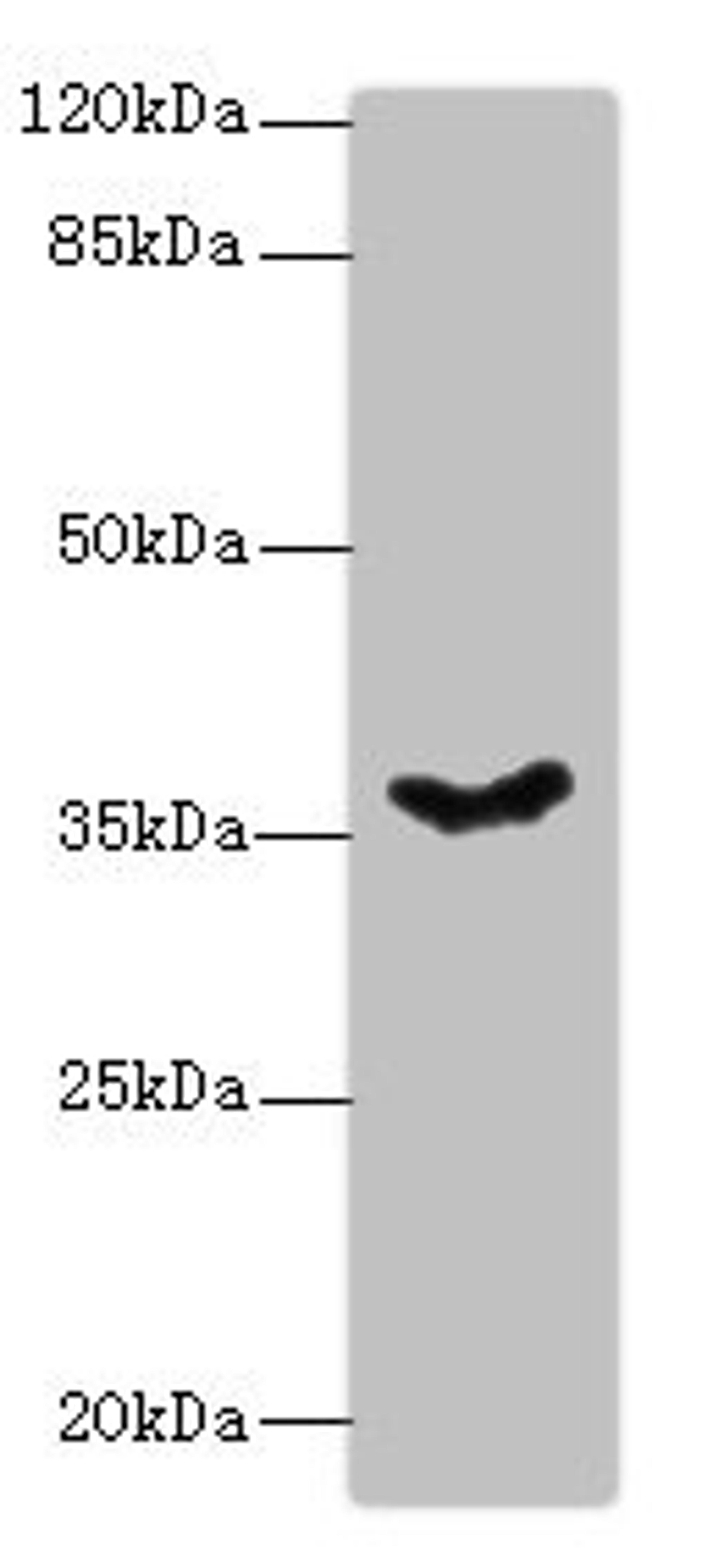 Western blot. All lanes: PSG11 antibody at 12ug/ml + Hela whole cell lysate. Secondary. Goat polyclonal to rabbit IgG at 1/10000 dilution. Predicted band size: 38, 24 kDa. Observed band size: 38 kDa.