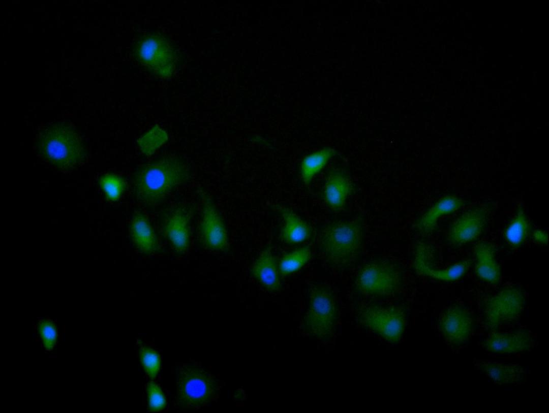 Immunofluorescence staining of hela cell with CSB-RA013826MA1HU at 1:60, counter-stained with DAPI. The cells were fixed in 4% formaldehyde and blocked in 10% normal Goat Serum. The cells were then incubated with the antibody overnight at 4C. The secondary antibody was FITC-conjugated AffiniPure Goat Anti-Human IgG(H+L).