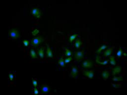 Immunofluorescence staining of hela cell with CSB-RA013826MA1HU at 1:60, counter-stained with DAPI. The cells were fixed in 4% formaldehyde and blocked in 10% normal Goat Serum. The cells were then incubated with the antibody overnight at 4C. The secondary antibody was FITC-conjugated AffiniPure Goat Anti-Human IgG(H+L).