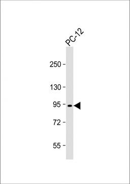 Western Blot at 1:1000 dilution + PC-12 whole cell lysate Lysates/proteins at 20 ug per lane.