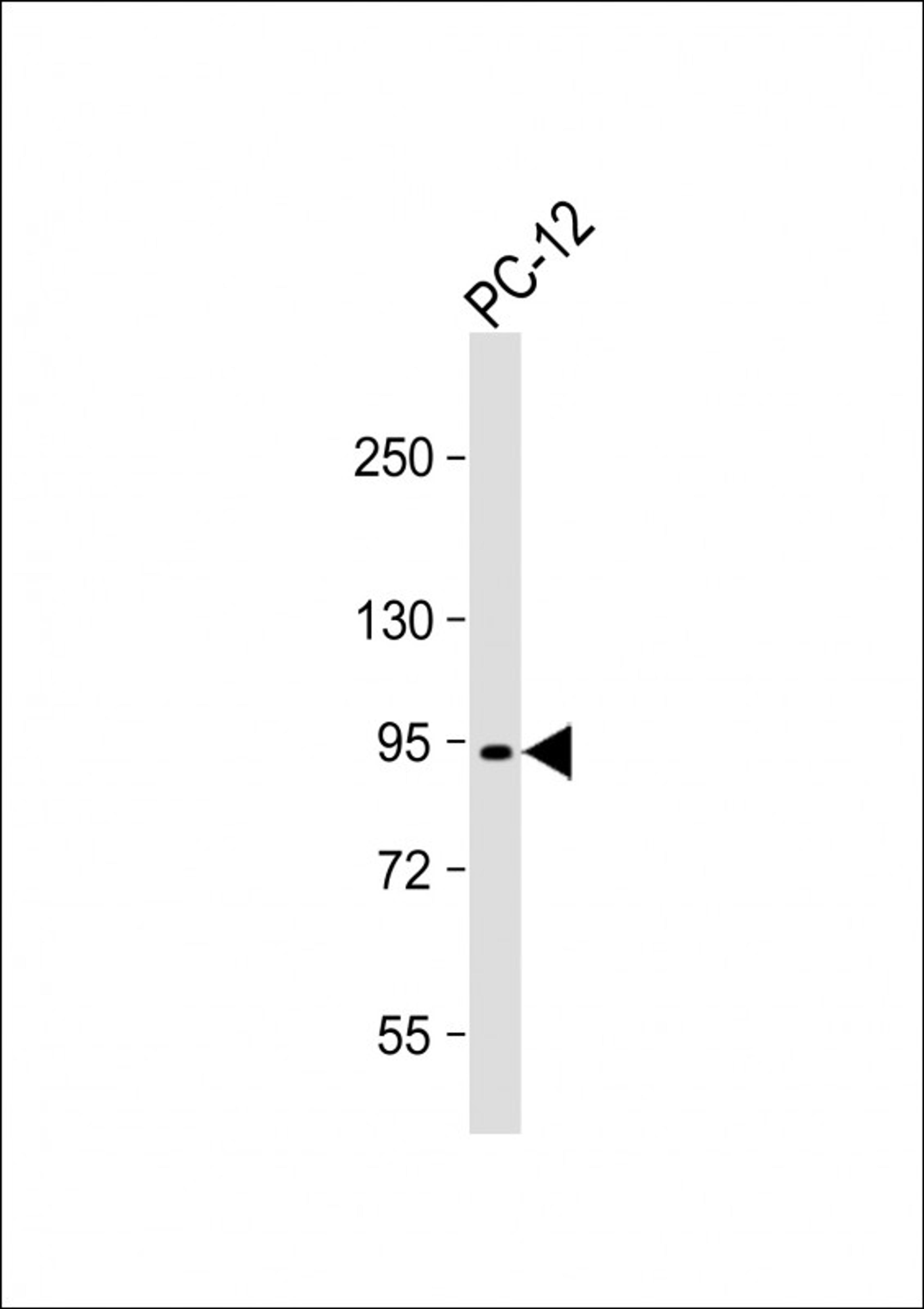 Western Blot at 1:1000 dilution + PC-12 whole cell lysate Lysates/proteins at 20 ug per lane.