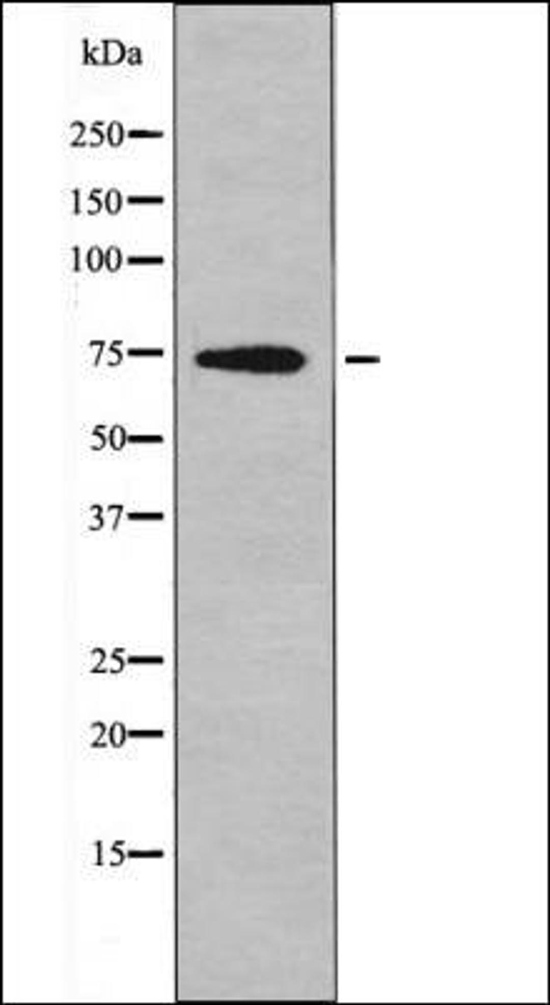 Western blot analysis of Jurkat whole cell lysates using C-RAF -Phospho-Tyr340- antibody