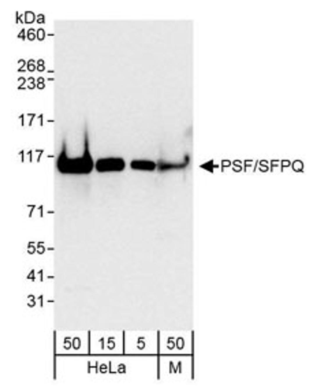 Detection of human and mouse PSF/SFPQ by western blot.