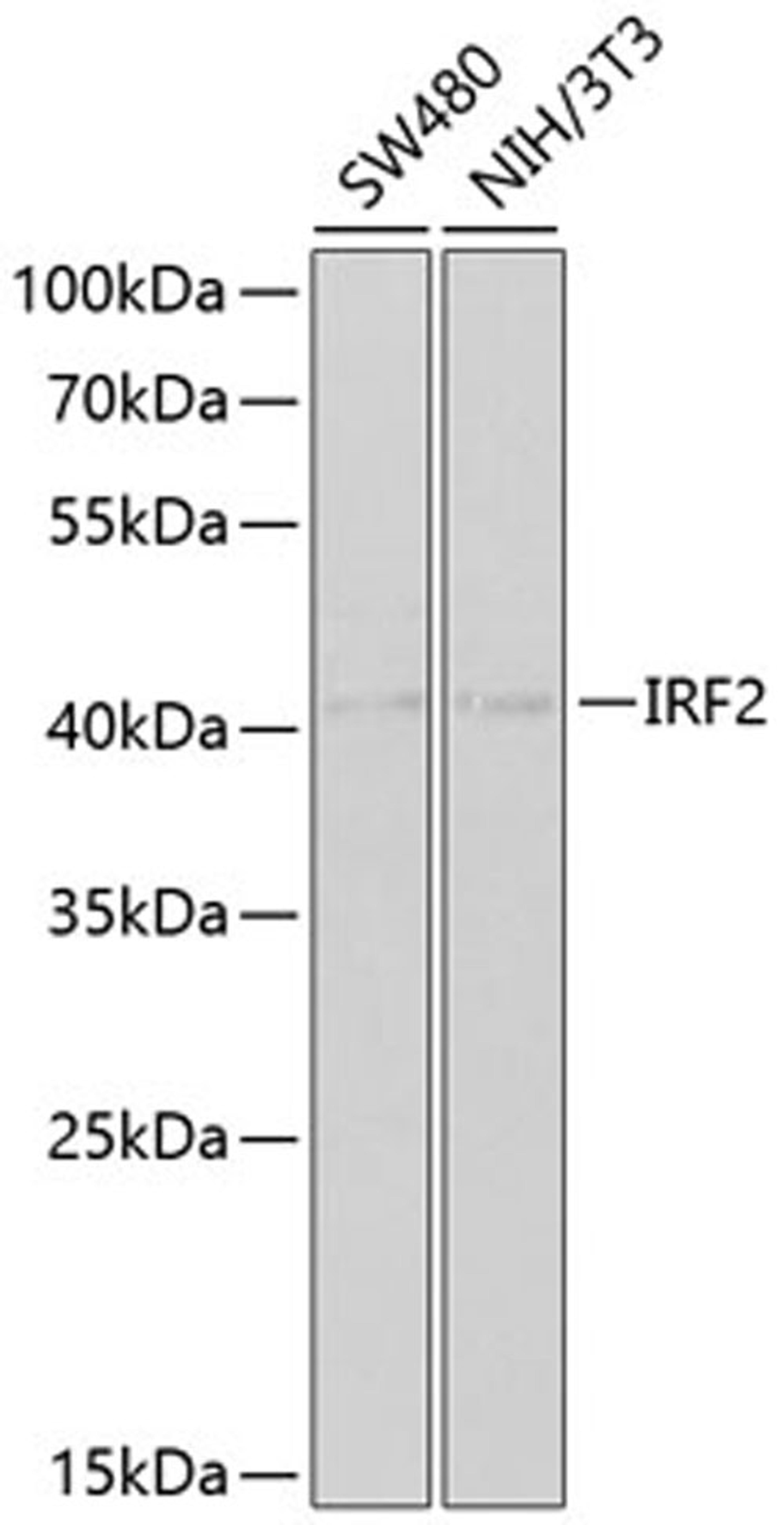 Western blot - IRF2 antibody (A2558)