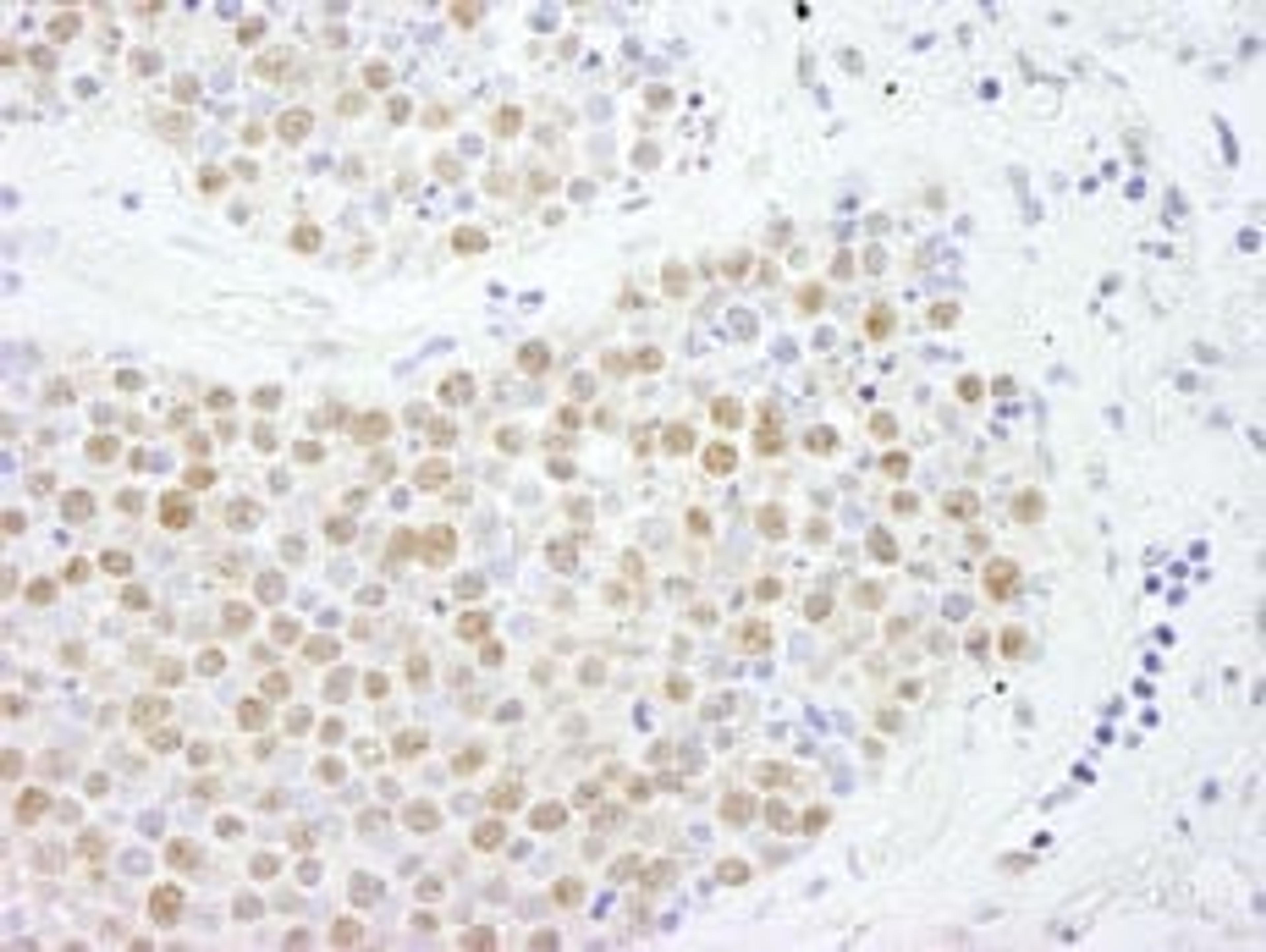 Detection of human FoxK2 by immunohistochemistry.