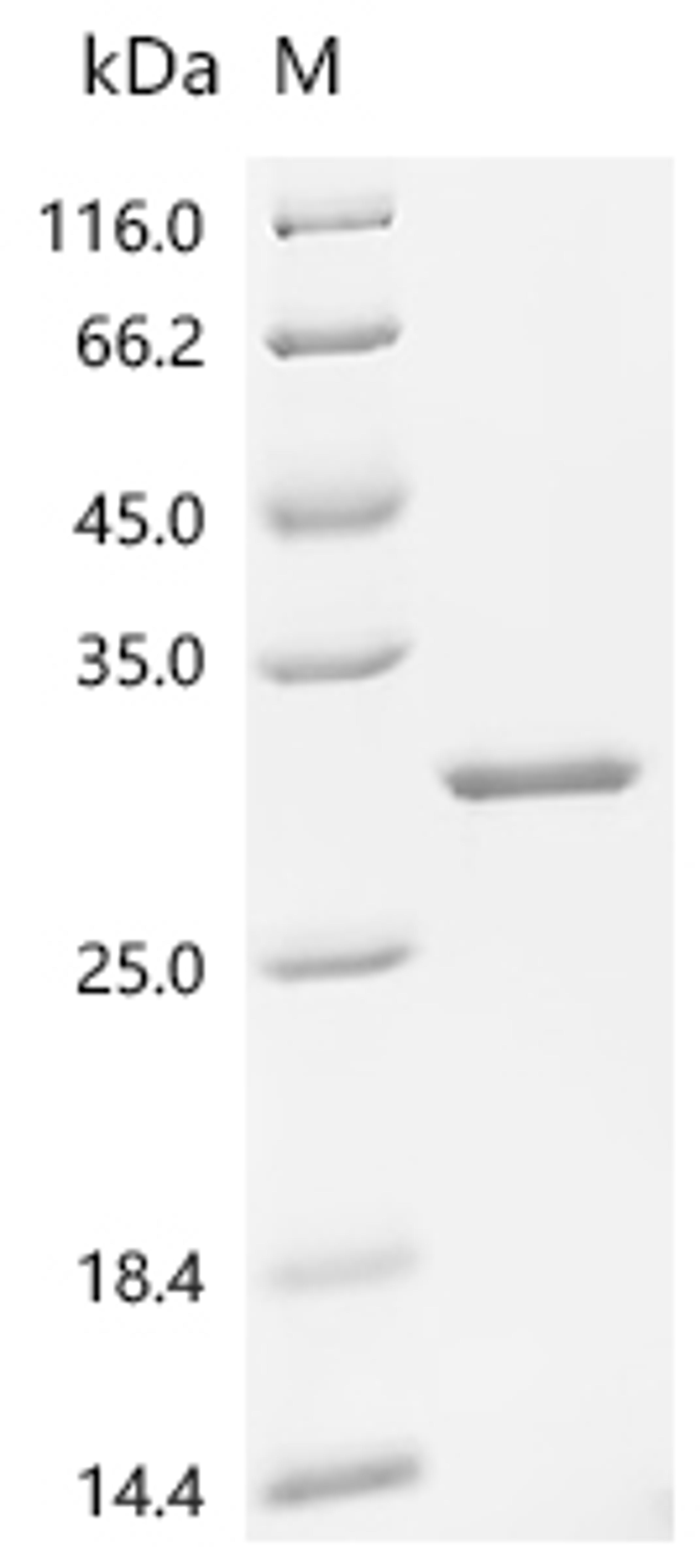 (Tris-Glycine gel) Discontinuous SDS-PAGE (reduced) with 5% enrichment gel and 15% separation gel.
