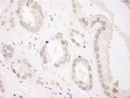 Detection of human USP34 by immunohistochemistry.