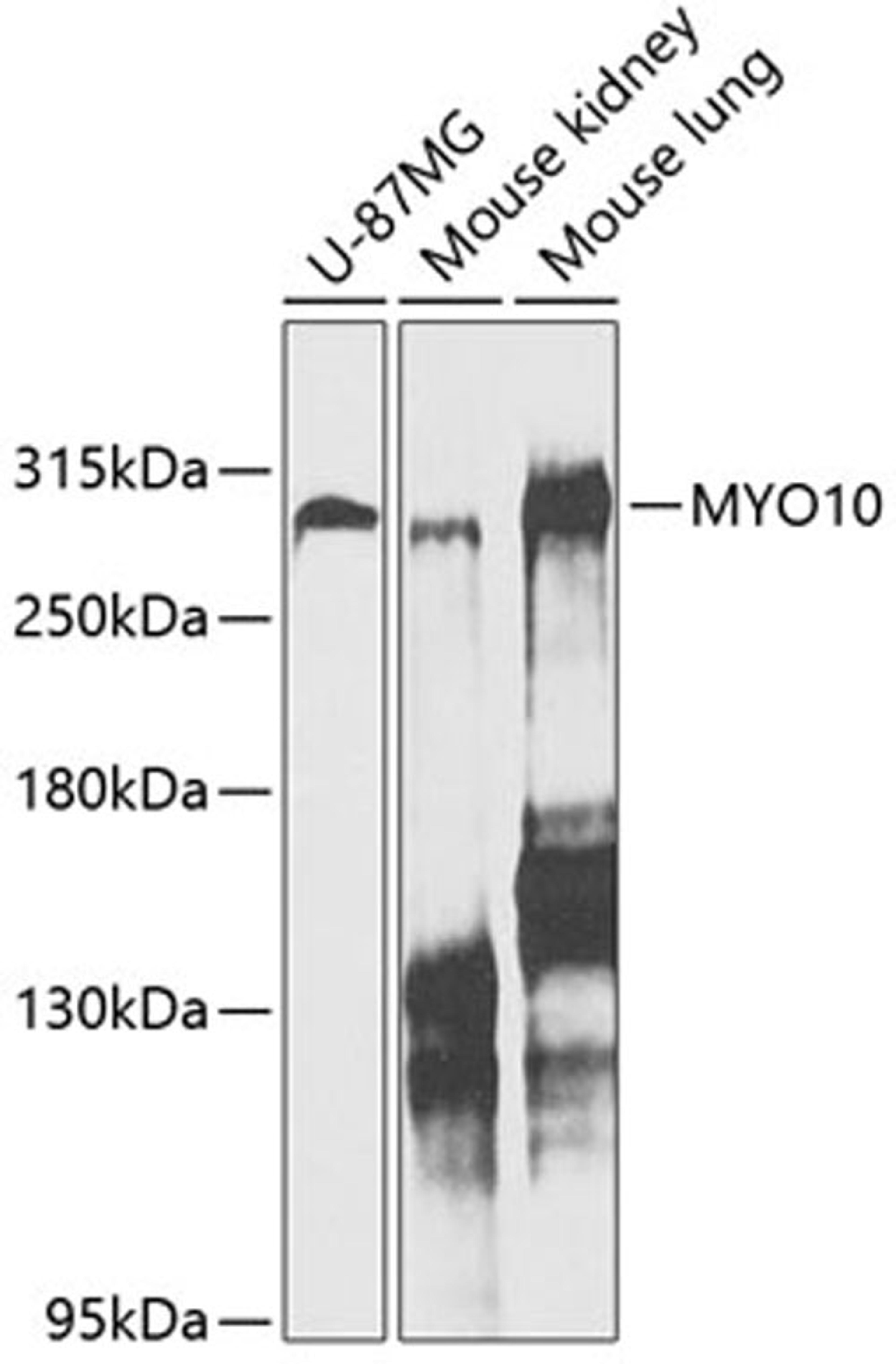 Western blot - MYO10 antibody (A12471)