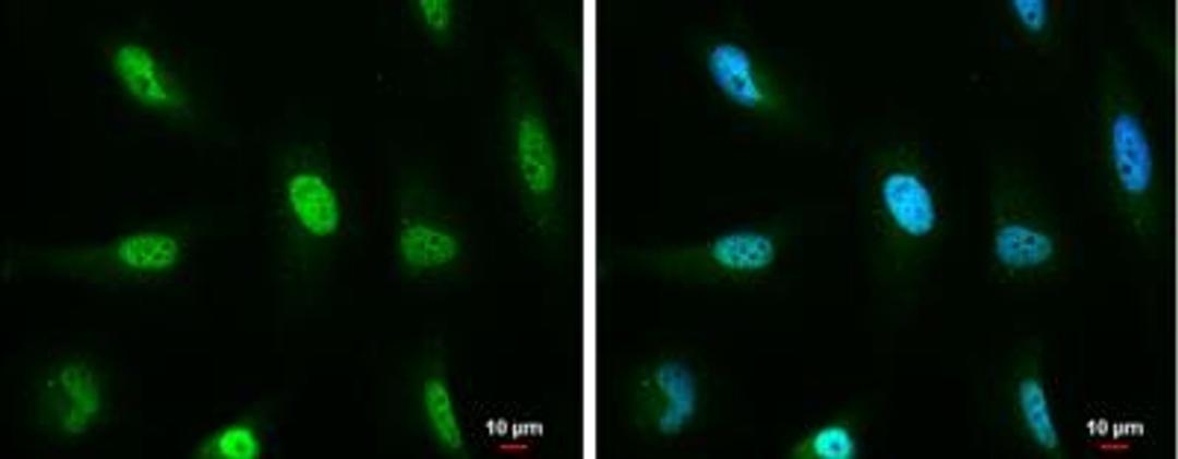 Immunocytochemistry/Immunofluorescence: ATM Antibody (5C2) [NB100-220] - HeLa cells were fixed in 4% paraformaldehyde at RT for 15 min. Green: ATM protein stained by ATM antibody [5C2]  diluted at 1:200. Blue: Hoechst 33342 staining. Scale bar = 10 um.