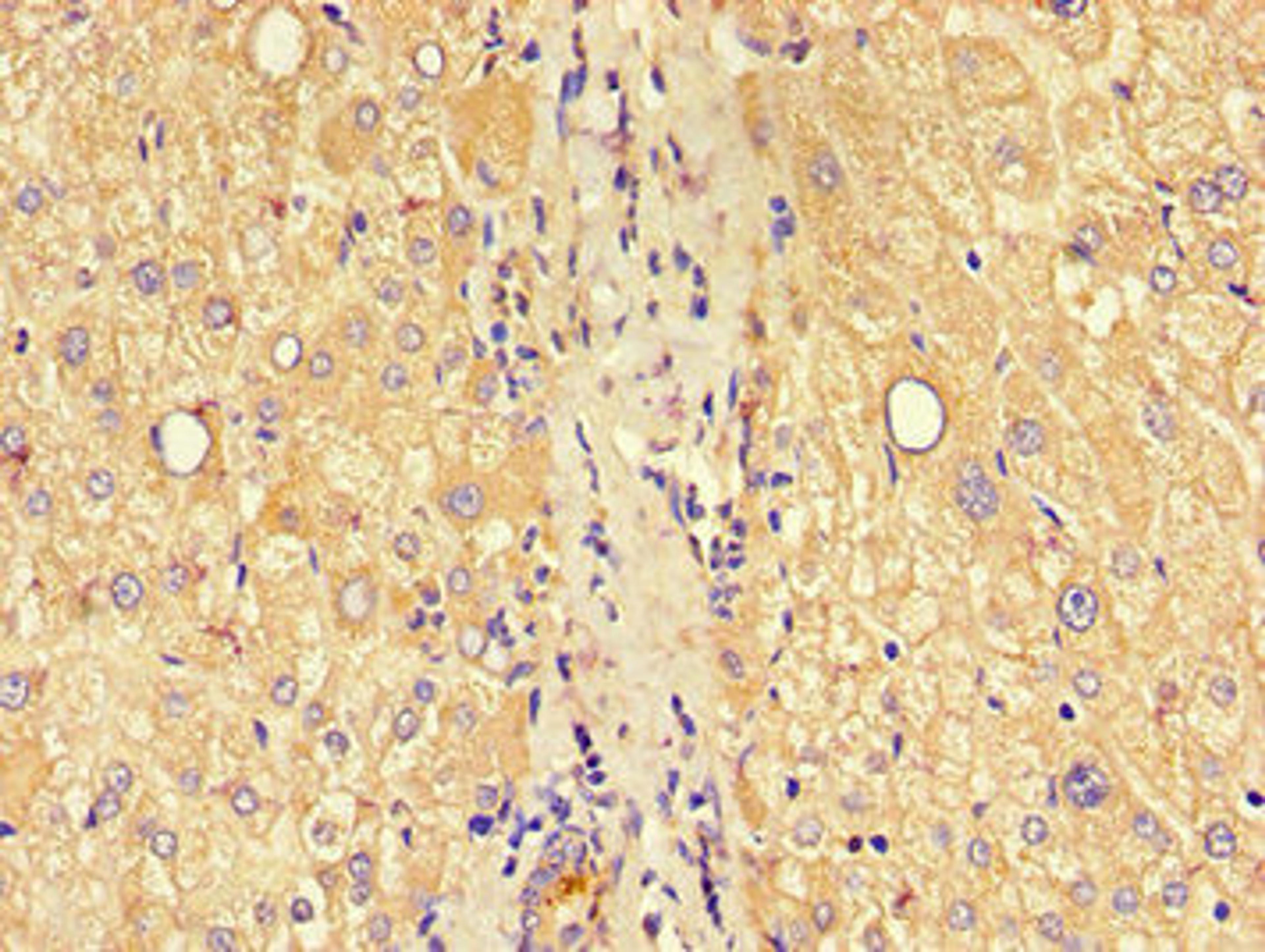 Immunohistochemistry of paraffin-embedded human liver tissue using CSB-PA005490LA01HU at dilution of 1:100