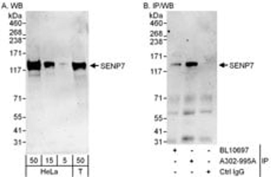 Detection of human SENP7 by western blot and immunoprecipitation.