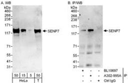 Detection of human SENP7 by western blot and immunoprecipitation.