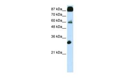 Antibody used in WB on Transfected 293T at 0.2-1 ug/ml.