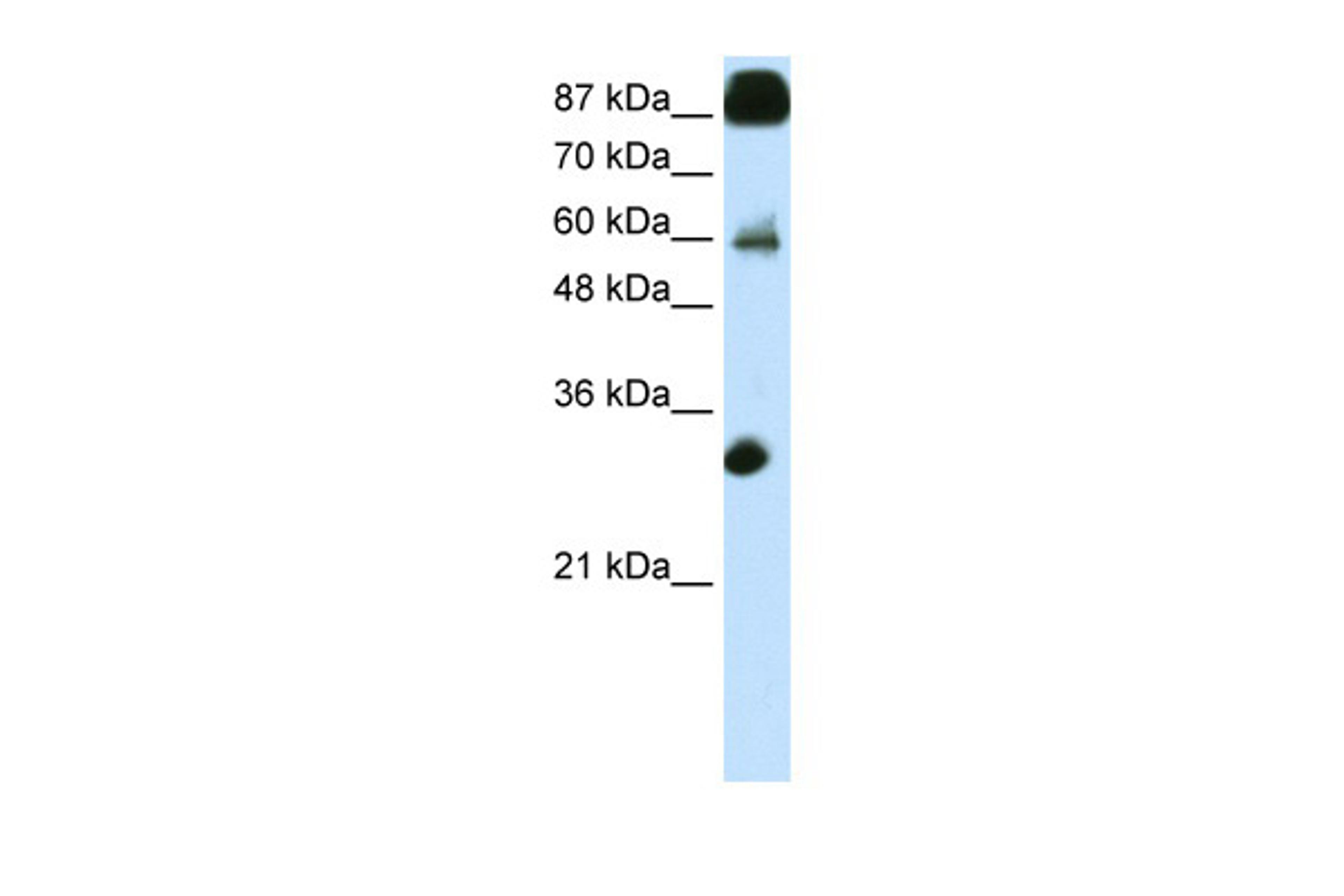 Antibody used in WB on Transfected 293T at 0.2-1 ug/ml.