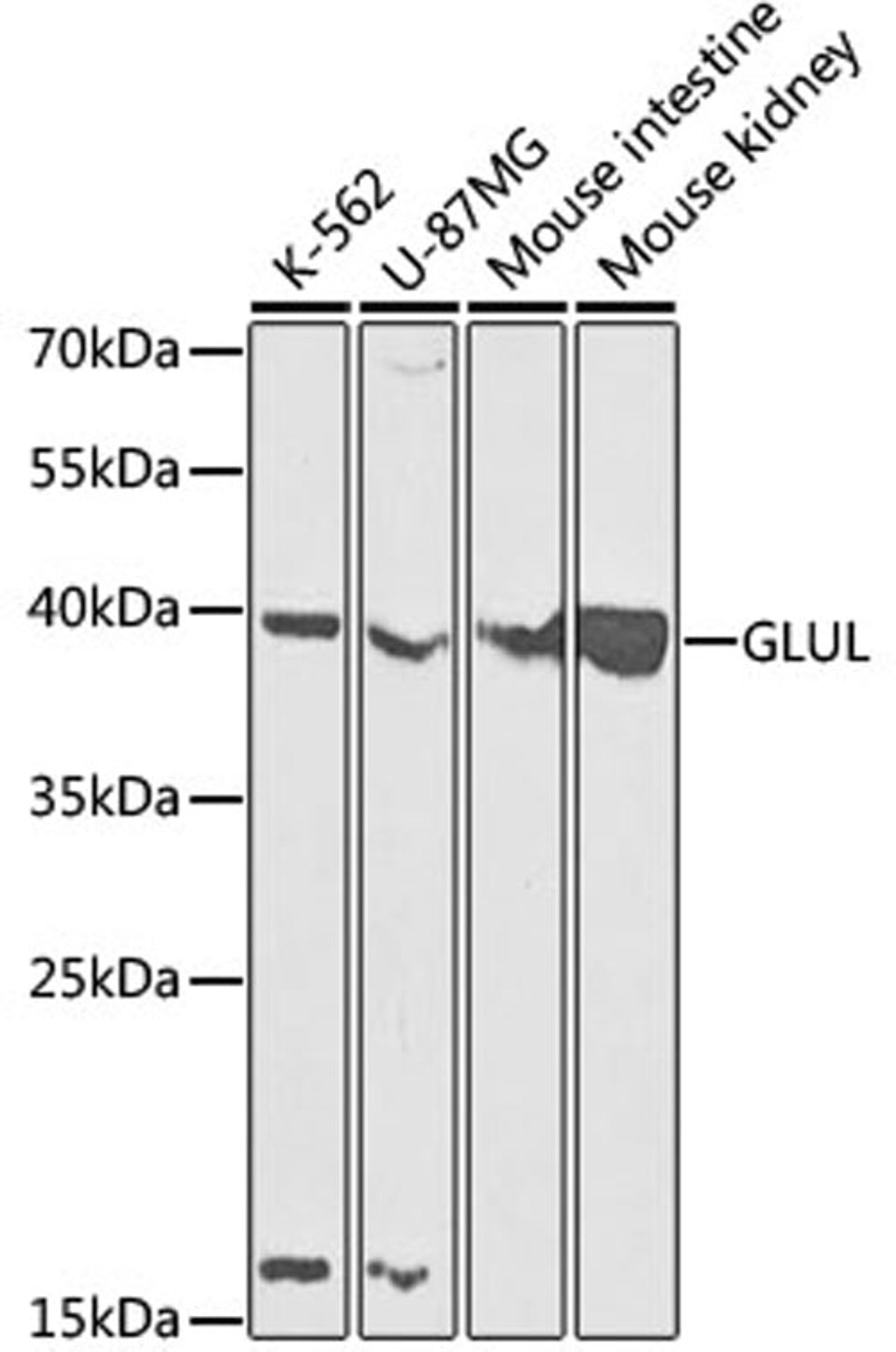 Western blot - GLUL antibody (A5437)