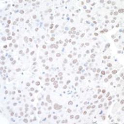 Detection of mouse BAF53A by immunohistochemistry.