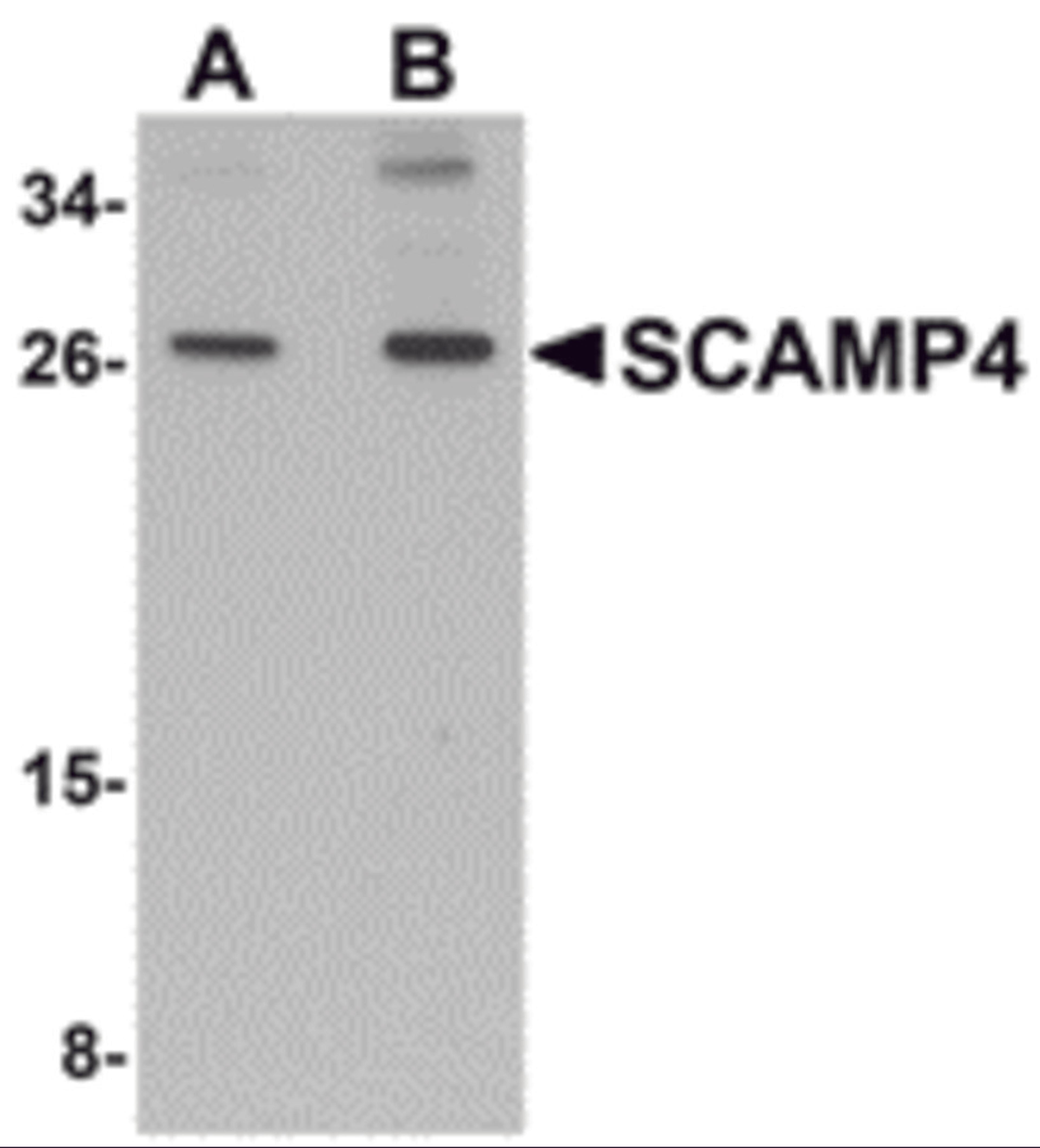 Western blot analysis of SCAMP4 in 3T3 cell lysate with SCAMP4 antibody at (A) 1 and (B) 2 &#956;g/mL.