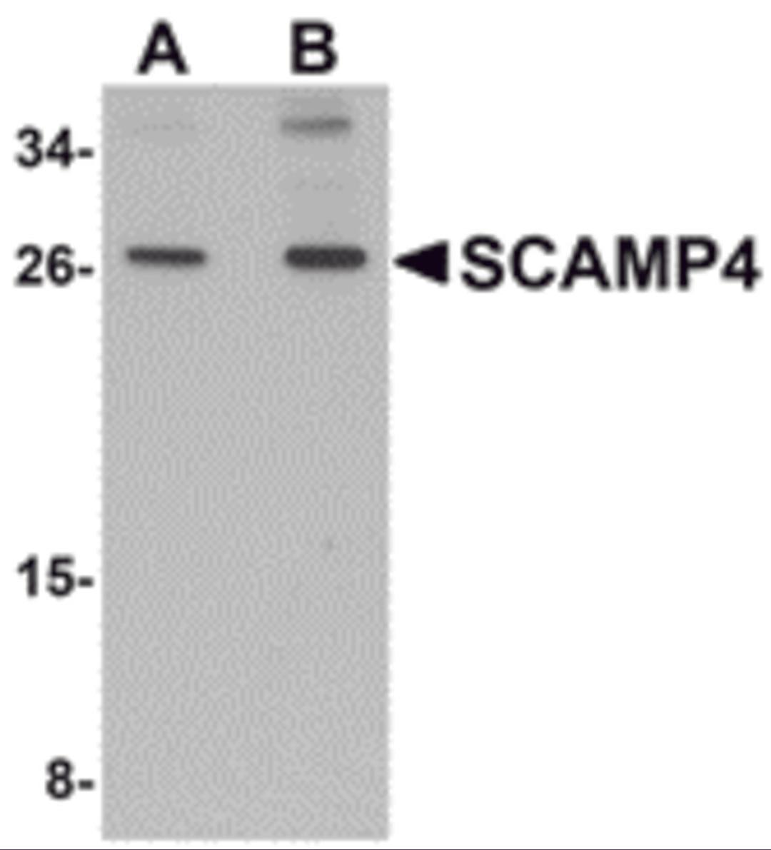 Western blot analysis of SCAMP4 in 3T3 cell lysate with SCAMP4 antibody at (A) 1 and (B) 2 μg/mL.