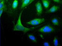 Immunocytochemistry/Immunofluorescence: HOMER1 Antibody [NBP1-44999] - Detection of HOMER1 (Green) in Hela cells using NBP1-44999. Nuclei (Blue) are counterstained using Hoechst 33258.