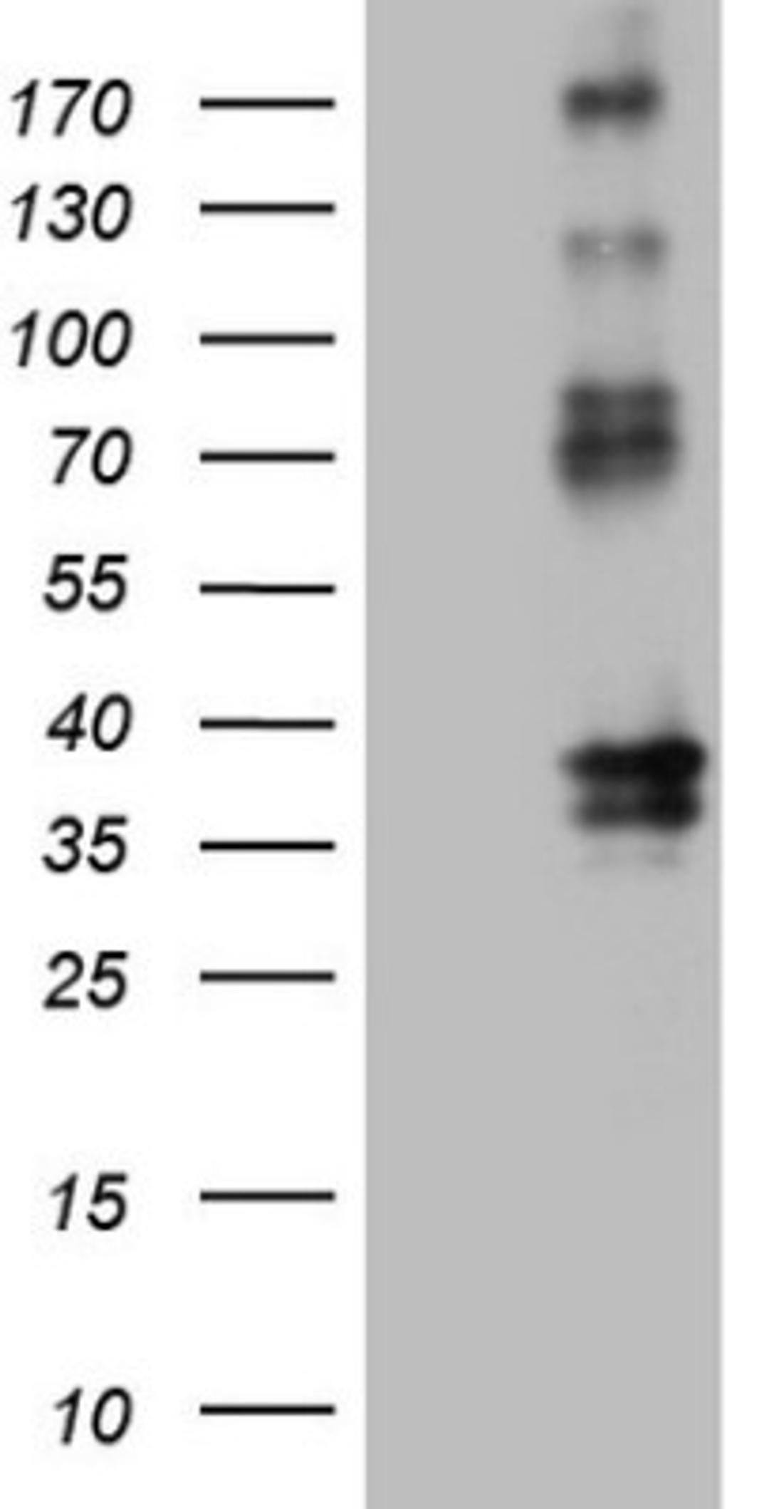 Western Blot: EPCR Antibody (12H5) [NBP2-45395] - Analysis of HEK293T cells were transfected with the pCMV6-ENTRY control (Left lane) or pCMV6-ENTRY EPCR.