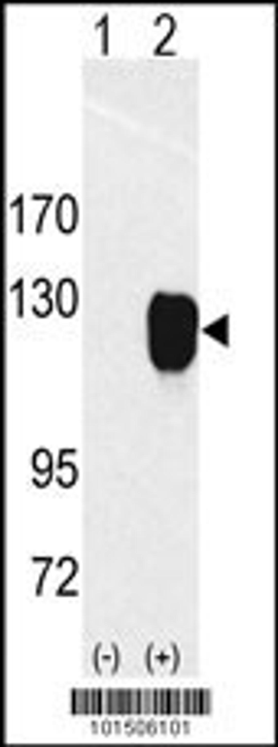 Western blot analysis of ROR1 using rabbit polyclonal ROR1 Antibody using 293 cell lysates (2 ug/lane) either nontransfected (Lane 1) or transiently transfected with the ROR1 gene (Lane 2).