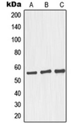 Western blot analysis of HepG2 (Lane 1), Raji (Lane 2), LOVO (Lane 3) whole cell lysates using GORASP2 antibody