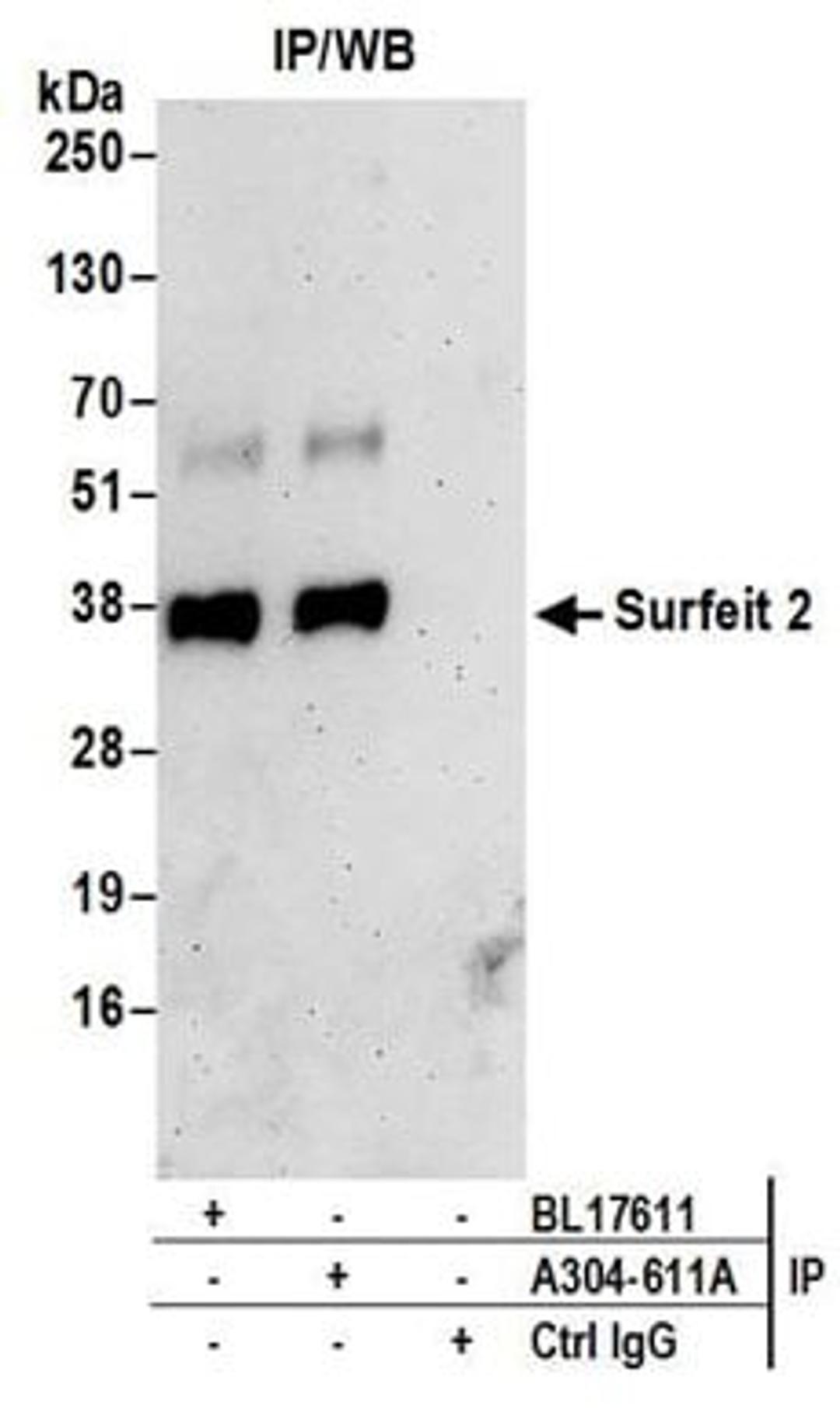 Detection of human Surfeit 2 by western blot of immunoprecipitates.