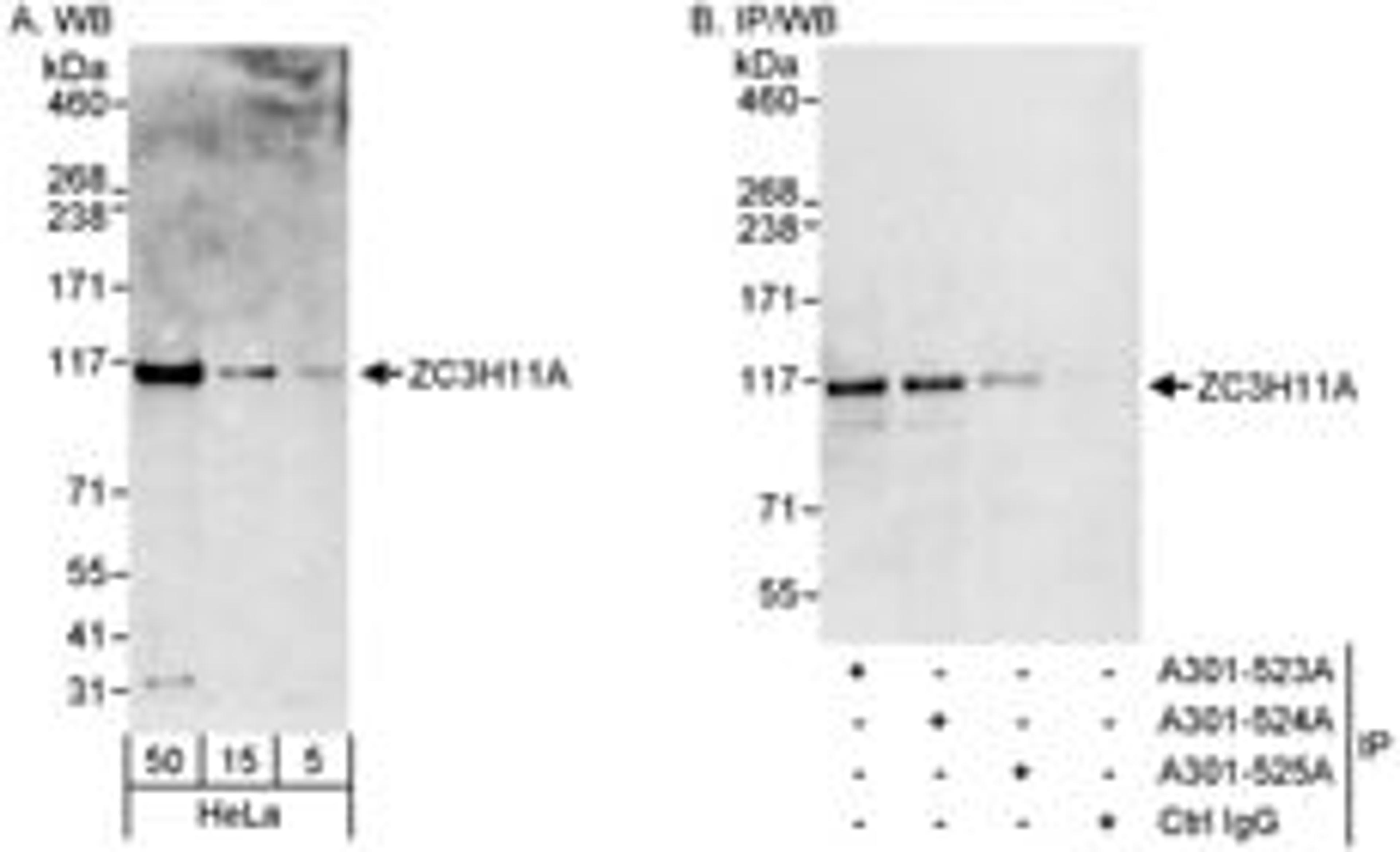 Detection of human ZC3H11A by western blot and immunoprecipitation.